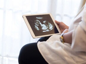 mujer con ecografía en la mano