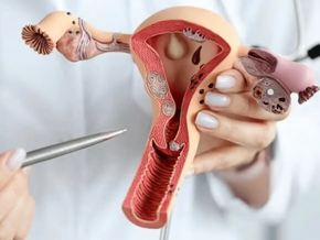 Maqueta ilustrativa de un útero con tapón mucoso