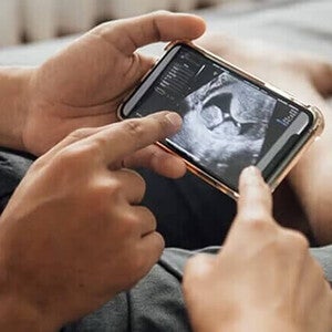 Close up de ultrasonido en un celular, manos de una pareja lo señalan