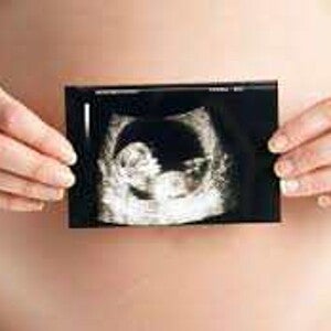 Ecografia de obstetricia