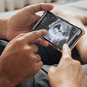 Preguntas que hacer en el ultrasonido de las 12 semanas