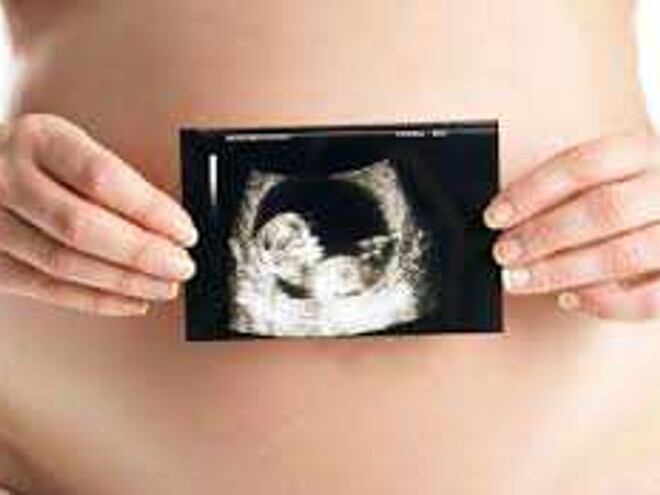 Ecografia obstetrica Ecografia obstetrica
